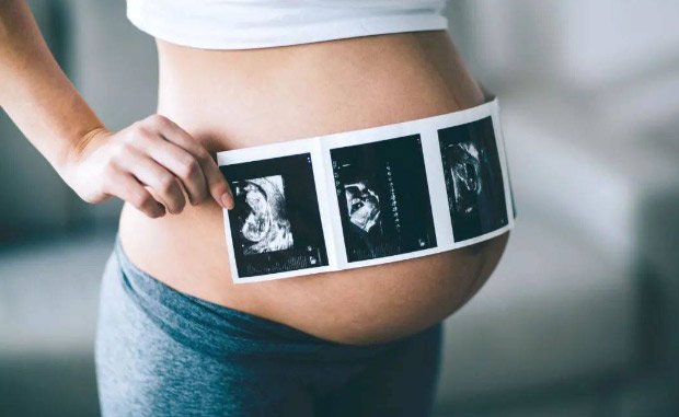 吉尔吉斯斯坦代孕流程